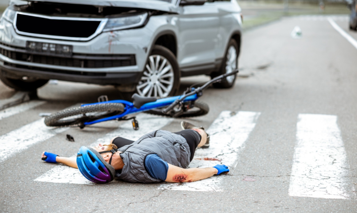 Bicycle Accident